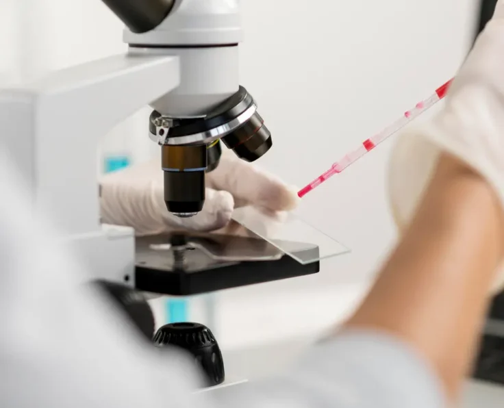 oncotype dx test